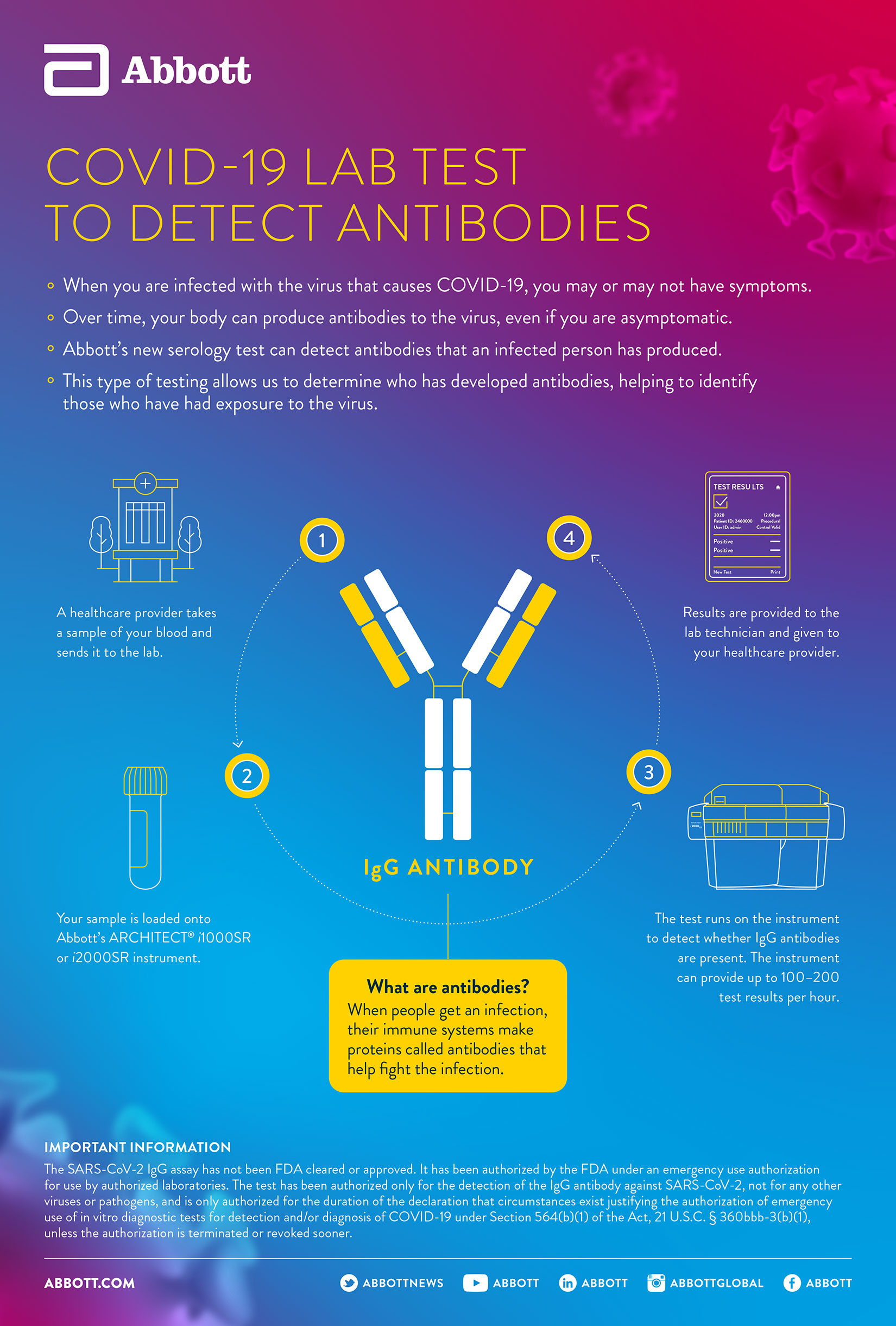 COVID-19 Lab Test to Detect Antibodies