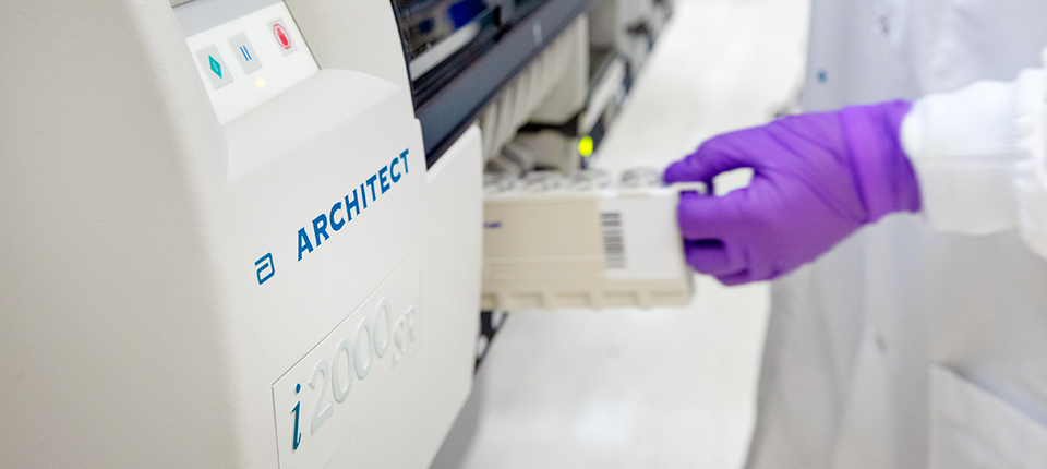 Abbott Launches COVID-19 Antibody Test