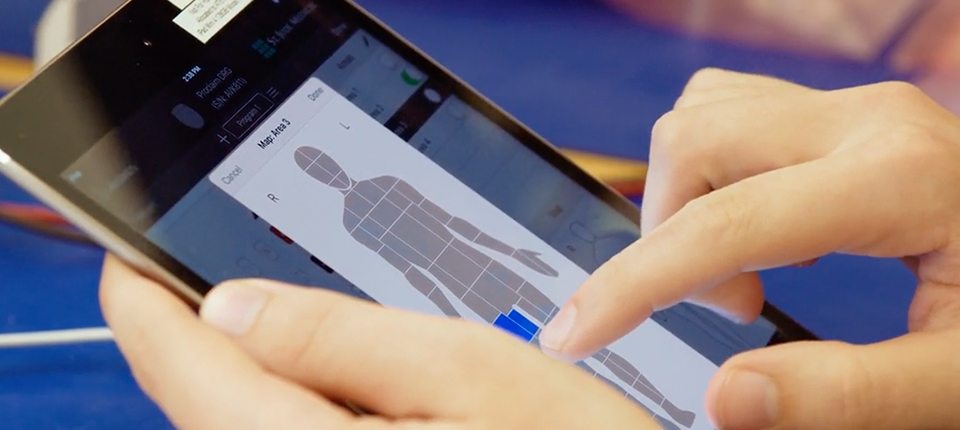 DRG: Life-Changing Technology for Chronic Pain