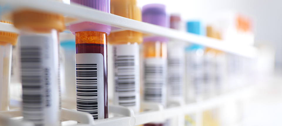 Hepatitis is testing us. We will not fail.