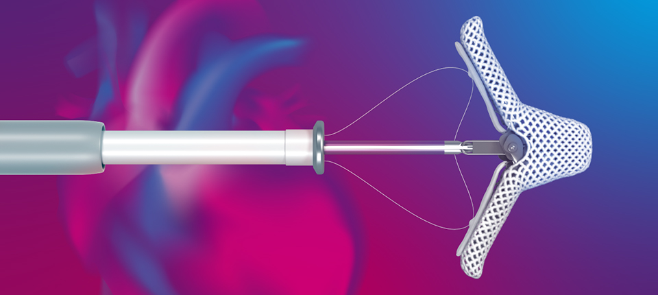 MitraClip Set for Significantly Broader Use