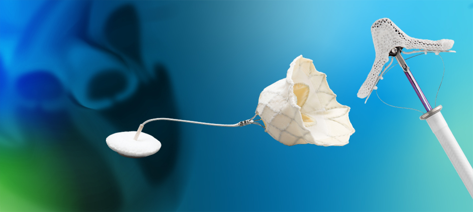 Abbott Adds to Structural Heart Tech


